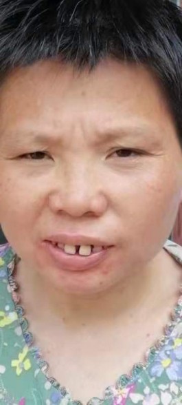 寻亲：漂小玲（拟取名）
